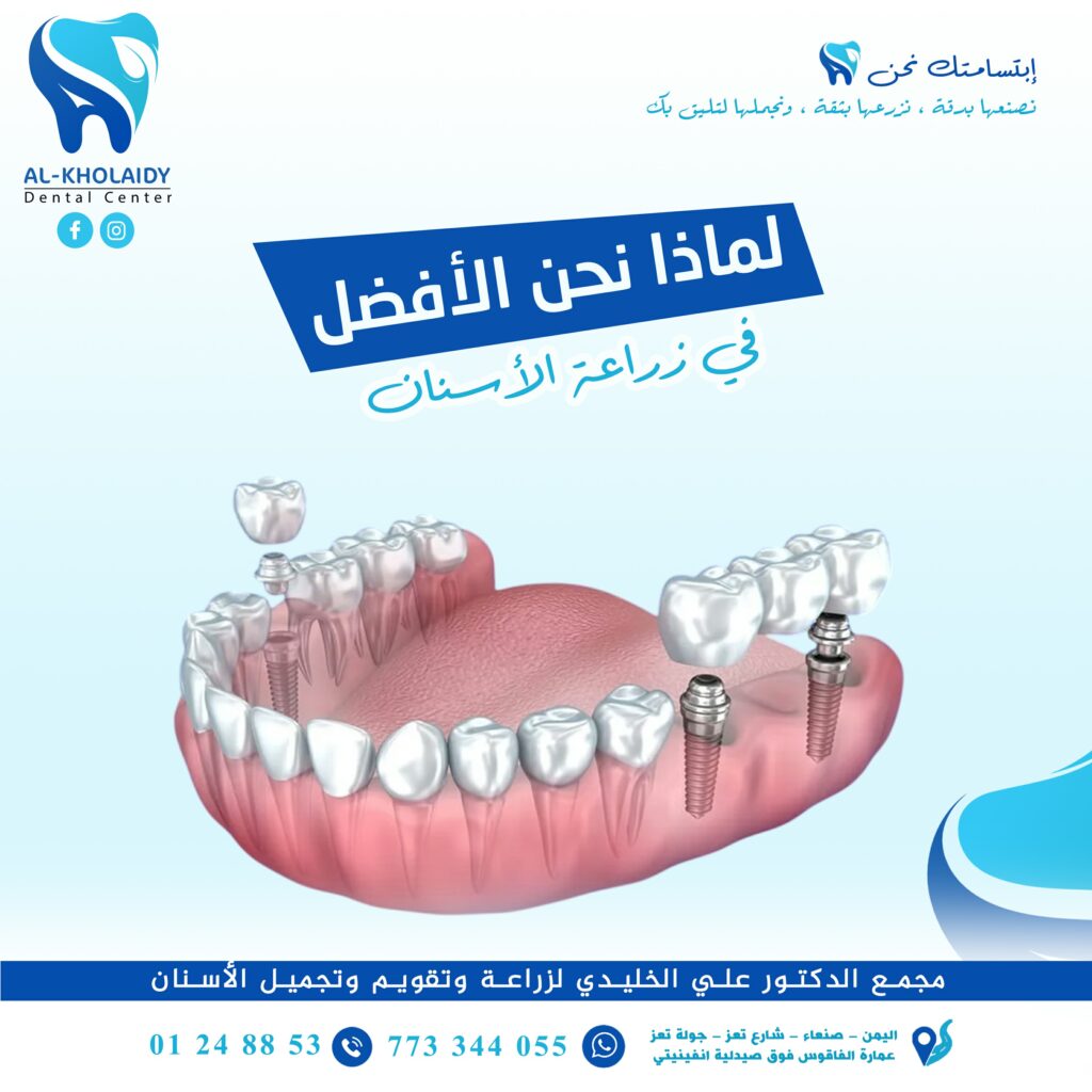 سعر زراعة الأسنان في صنعاء ، اليمن تكلفة زراعة الأسنان في صنعاء ، اليمن زراعة الأسنان في صنعاء ، اليمن أفضل دكتور زراعة أسنان في صنعاء ، اليمن دكتور زراعة أسنان في صنعاء ، اليمن أفضل مركز زراعة أسنان في صنعاء ، اليمن أفضل عيادة زراعة أسنان في صنعاء ، اليمن سعر زراعة الأسنان في صنعاء ، اليمن تكلفة زراعة الأسنان في صنعاء ، اليمن زراعة الأسنان في صنعاء ، اليمن أفضل دكتور زراعة أسنان في صنعاء ، اليمن دكتور زراعة أسنان في صنعاء ، اليمن أفضل مركز زراعة أسنان في صنعاء ، اليمن أفضل عيادة زراعة أسنان في صنعاء ، اليمن سعر زراعة الأسنان في صنعاء ، اليمن تكلفة زراعة الأسنان في صنعاء ، اليمن زراعة الأسنان في صنعاء ، اليمن أفضل دكتور زراعة أسنان في صنعاء ، اليمن دكتور زراعة أسنان في صنعاء ، اليمن أفضل مركز زراعة أسنان في صنعاء ، اليمن أفضل عيادة زراعة أسنان في صنعاء ، اليمن سعر زراعة الأسنان في صنعاء ، اليمن تكلفة زراعة الأسنان في صنعاء ، اليمن زراعة الأسنان في صنعاء ، اليمن أفضل دكتور زراعة أسنان في صنعاء ، اليمن دكتور زراعة أسنان في صنعاء ، اليمن أفضل مركز زراعة أسنان في صنعاء ، اليمن أفضل عيادة زراعة أسنان في صنعاء ، اليمن سعر زراعة الأسنان في صنعاء ، اليمن تكلفة زراعة الأسنان في صنعاء ، اليمن زراعة الأسنان في صنعاء ، اليمن أفضل دكتور زراعة أسنان في صنعاء ، اليمن دكتور زراعة أسنان في صنعاء ، اليمن أفضل مركز زراعة أسنان في صنعاء ، اليمن أفضل عيادة زراعة أسنان في صنعاء ، اليمن سعر زراعة الأسنان في صنعاء ، اليمن تكلفة زراعة الأسنان في صنعاء ، اليمن زراعة الأسنان في صنعاء ، اليمن أفضل دكتور زراعة أسنان في صنعاء ، اليمن دكتور زراعة أسنان في صنعاء ، اليمن أفضل مركز زراعة أسنان في صنعاء ، اليمن أفضل عيادة زراعة أسنان في صنعاء ، اليمن سعر زراعة الأسنان في صنعاء ، اليمن تكلفة زراعة الأسنان في صنعاء ، اليمن زراعة الأسنان في صنعاء ، اليمن أفضل دكتور زراعة أسنان في صنعاء ، اليمن دكتور زراعة أسنان في صنعاء ، اليمن أفضل مركز زراعة أسنان في صنعاء ، اليمن أفضل عيادة زراعة أسنان في صنعاء ، اليمن سعر زراعة الأسنان في صنعاء ، اليمن تكلفة زراعة الأسنان في صنعاء ، اليمن زراعة الأسنان في صنعاء ، اليمن أفضل دكتور زراعة أسنان في صنعاء ، اليمن دكتور زراعة أسنان في صنعاء ، اليمن أفضل مركز زراعة أسنان في صنعاء ، اليمن أفضل عيادة زراعة أسنان في صنعاء ، اليمن سعر زراعة الأسنان في صنعاء ، اليمن تكلفة زراعة الأسنان في صنعاء ، اليمن زراعة الأسنان في صنعاء ، اليمن أفضل دكتور زراعة أسنان في صنعاء ، اليمن دكتور زراعة أسنان في صنعاء ، اليمن أفضل مركز زراعة أسنان في صنعاء ، اليمن أفضل عيادة زراعة أسنان في صنعاء ، اليمن سعر زراعة الأسنان في صنعاء ، اليمن تكلفة زراعة الأسنان في صنعاء ، اليمن زراعة الأسنان في صنعاء ، اليمن أفضل دكتور زراعة أسنان في صنعاء ، اليمن دكتور زراعة أسنان في صنعاء ، اليمن أفضل مركز زراعة أسنان في صنعاء ، اليمن أفضل عيادة زراعة أسنان في صنعاء ، اليمن سعر زراعة الأسنان في صنعاء ، اليمن تكلفة زراعة الأسنان في صنعاء ، اليمن زراعة الأسنان في صنعاء ، اليمن أفضل دكتور زراعة أسنان في صنعاء ، اليمن دكتور زراعة أسنان في صنعاء ، اليمن أفضل مركز زراعة أسنان في صنعاء ، اليمن أفضل عيادة زراعة أسنان في صنعاء ، اليمن سعر زراعة الأسنان في صنعاء ، اليمن تكلفة زراعة الأسنان في صنعاء ، اليمن زراعة الأسنان في صنعاء ، اليمن أفضل دكتور زراعة أسنان في صنعاء ، اليمن دكتور زراعة أسنان في صنعاء ، اليمن أفضل مركز زراعة أسنان في صنعاء ، اليمن أفضل عيادة زراعة أسنان في صنعاء ، اليمن سعر زراعة الأسنان في صنعاء ، اليمن تكلفة زراعة الأسنان في صنعاء ، اليمن زراعة الأسنان في صنعاء ، اليمن أفضل دكتور زراعة أسنان في صنعاء ، اليمن دكتور زراعة أسنان في صنعاء ، اليمن أفضل مركز زراعة أسنان في صنعاء ، اليمن أفضل عيادة زراعة أسنان في صنعاء ، اليمن سعر زراعة الأسنان في صنعاء ، اليمن تكلفة زراعة الأسنان في صنعاء ، اليمن زراعة الأسنان في صنعاء ، اليمن أفضل دكتور زراعة أسنان في صنعاء ، اليمن دكتور زراعة أسنان في صنعاء ، اليمن أفضل مركز زراعة أسنان في صنعاء ، اليمن أفضل عيادة زراعة أسنان في صنعاء ، اليمن سعر زراعة الأسنان في صنعاء ، اليمن تكلفة زراعة الأسنان في صنعاء ، اليمن زراعة الأسنان في صنعاء ، اليمن أفضل دكتور زراعة أسنان في صنعاء ، اليمن دكتور زراعة أسنان في صنعاء ، اليمن أفضل مركز زراعة أسنان في صنعاء ، اليمن أفضل عيادة زراعة أسنان في صنعاء ، اليمن